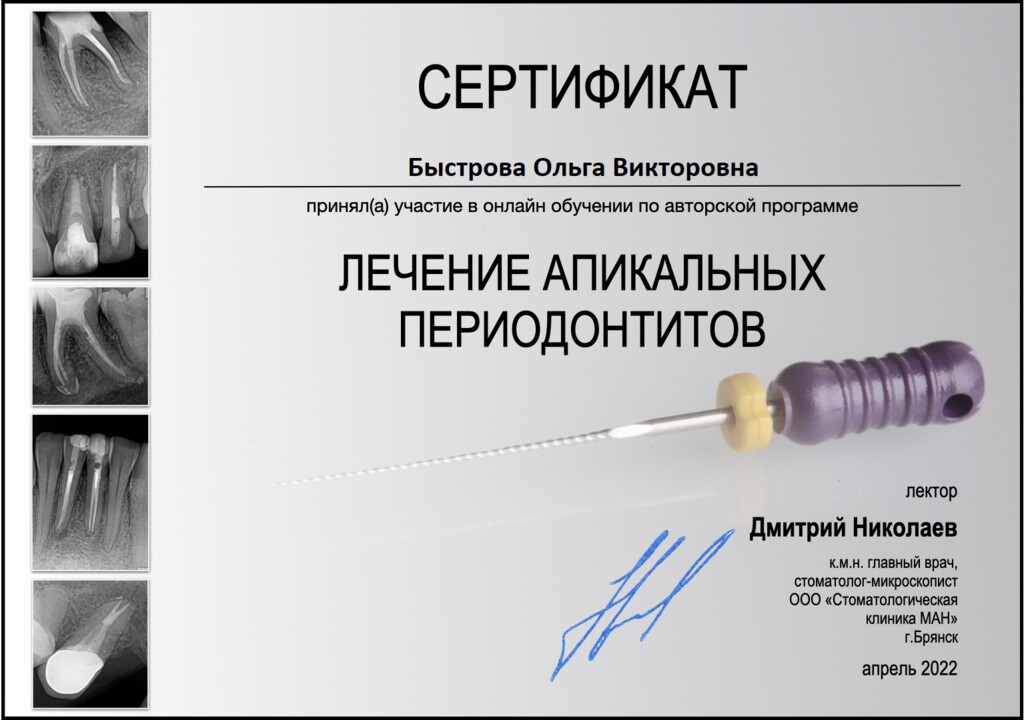 Онлайн обучение авторской программе "Лечение апикальных периодонтитов" у Николаева Дмитрия.